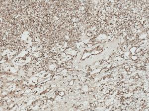 Immunohistochemistry analysis of human kidney, fixed in formalin and paraffin-embedded. The Primary Antibody used was Anti-ATG7 Antibody (A305057) at 1:50 for 30 minutes at room temperature. Counterstain: Hematoxylin. Magnification: 10X