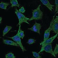 Anti-MAP2K6 Mouse Monoclonal Antibody [clone: 3H12C8]