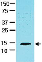 Anti-FABP1 Mouse Monoclonal Antibody [clone: 2G4]