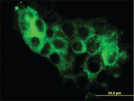 Anti-STEAP1 Mouse Monoclonal Antibody [clone: 4F6-1F3]