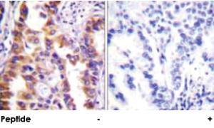 Anti-TSC2 Rabbit Polyclonal Antibody