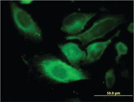 Anti-TSSC1 Mouse Monoclonal Antibody [clone: 2H5]