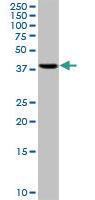 Anti-RRM2 Mouse Monoclonal Antibody [clone: 1E1]