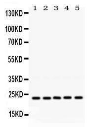 Anti-Rab18 Rabbit Polyclonal Antibody