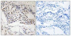 Antibody anti-MYSM1 100 µg