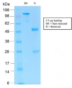 Anti-CD31 antibody