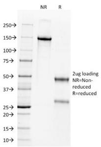 Anti-Wilms Tumor Protein Mouse Monoclonal Antibody [clone: WT1/857]