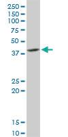 Anti-DNAJB6 Rabbit Polyclonal Antibody