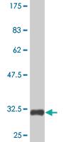 Anti-NME8 Mouse Monoclonal Antibody [clone: 1G5]