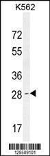 Anti-OR52D1 Rabbit Polyclonal Antibody (AP (Alkaline Phosphatase))