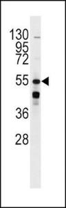 Anti-ADRB2 Rabbit Polyclonal Antibody (AP (Alkaline Phosphatase))