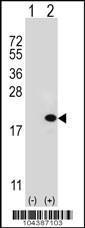 Anti-UBE2V1 Rabbit Polyclonal Antibody (FITC (Fluorescein))