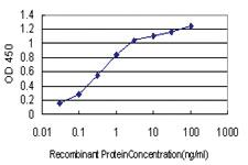 Anti-CYP46A1 Mouse Monoclonal Antibody [clone: 1A11]