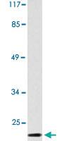 Anti-GZMH Rabbit Polyclonal Antibody