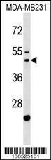 Anti-GATSL1 Rabbit Polyclonal Antibody (AP (Alkaline Phosphatase))