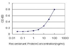 Anti-TSSC1 Mouse Monoclonal Antibody [clone: 2H5]