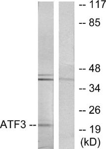 Western blot analysis of lysates from RAW264.7 cells using Anti-ATF3 Antibody. The right hand lane represents a negative control, where the antibody is blocked by the immunising peptide