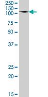 Anti-DPP4 Goat Polyclonal Antibody