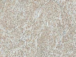 Immunohistochemistry analysis of human brain, fixed in formalin and paraffin-embedded. The Primary Antibody used was Anti-ATG7 Antibody (A305058) at 1:50 for 31 min at room temperature. Counterstain: Hematoxylin. Magnification: 10X