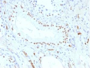 Anti-Wilms Tumor Protein Mouse Monoclonal Antibody [clone: WT1/857]