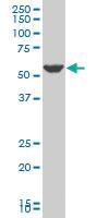 Anti-PTGIS Mouse Polyclonal Antibody