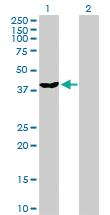 Anti-DNAJB6 Rabbit Polyclonal Antibody