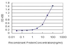 Anti-STEAP1 Mouse Monoclonal Antibody [clone: 4F6-1F3]