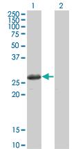 Anti-TSSK3 Mouse Monoclonal Antibody [clone: 3G8]