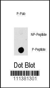 Anti-CROT Rabbit polyclonal antibody