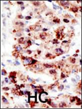 Anti-UBC Rabbit Polyclonal Antibody (AP (Alkaline Phosphatase))