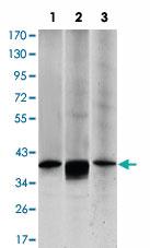 Anti-MAP2K6 Mouse Monoclonal Antibody [clone: 3H12B9]