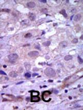 Anti-RET Rabbit Polyclonal Antibody (HRP (Horseradish Peroxidase))