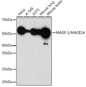 Western blot analysis of extracts of various cell lines, using Anti-MAGEA1 Antibody [ARC1839] (A309087) at 1:1,000 dilution. The secondary antibody was Goat Anti-Rabbit IgG H&L Antibody (HRP) at 1:10,000 dilution.