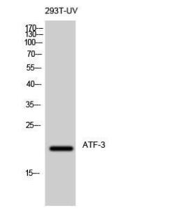 Western blot analysis of 293T UV cells using Anti-ATF3 Antibody