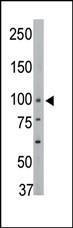 Anti-PTPN3 Rabbit Polyclonal Antibody (FITC (Fluorescein))