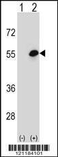 Anti-COCH Rabbit Polyclonal Antibody (AP (Alkaline Phosphatase))