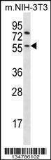 Anti-GSK3B Rabbit Polyclonal Antibody (HRP (Horseradish Peroxidase))