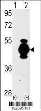 Anti-GFAP Rabbit Polyclonal Antibody (Biotin)