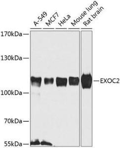 Western blot analysis of extracts of various cell lines, using Anti-EXOC2 Antibody (A307844) at 1:1,000 dilution. The secondary antibody was Goat Anti-Rabbit IgG H&L Antibody (HRP) at 1:10,000 dilution.