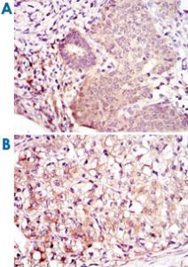 Anti-MAP2K6 Mouse Monoclonal Antibody [clone: 3H12B9]