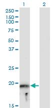 Anti-MYLPF Mouse Monoclonal Antibody [clone: 3H3]