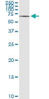 Anti-SOX30 Polyclonal Antibody Pair