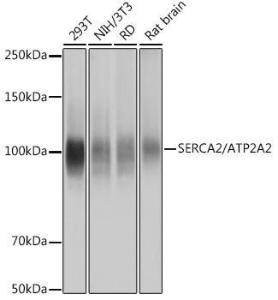 Western blot analysis of extracts of various cell lines, using Anti-SERCA2 ATPase Antibody [ARC0679] (A306176) at 1:1,000 dilution. The secondary antibody was Goat Anti-Rabbit IgG H&L Antibody (HRP) at 1:10,000 dilution.