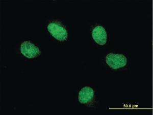 Anti-FOXQ1 Mouse Monoclonal Antibody [clone: 4H8]