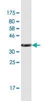 Anti-NPHS1 Mouse Monoclonal Antibody [clone: 3H6]