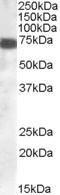 Anti-ZDHHC13 Antibody (A83315) (0.1 µg/ml) staining of Human Cerebellum lysate (35 µg protein in RIPA buffer). Primary incubation was 1 hour. Detected by chemilu minescence