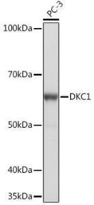 Western blot analysis of extracts of PC-3 cells, using Anti-DKC1 / Dyskerin Antibody [ARC1063] (A309088) at 1:1,000 dilution. The secondary antibody was Goat Anti-Rabbit IgG H&L Antibody (HRP) at 1:10,000 dilution.