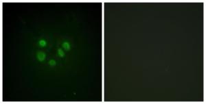 Immunofluorescence analysis of A549 cells using Anti-Bloom Syndrome Antibody. The right hand panel represents a negative control, where the antibody was pre-incubated with the immunising peptide