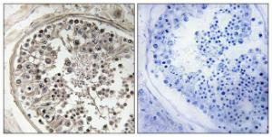 Immunohistochemical analysis of paraffin-embedded human testis using Anti-MRPS5 Antibody. The right hand panel represents a negative control, where the antibody was pre-incubated with the immunising peptide.