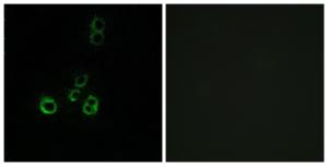 Immunofluorescence analysis of MCF7 cells using Anti-OR51F2 Antibody. The right hand panel represents a negative control, where the antibody was pre-incubated with the immunising peptide